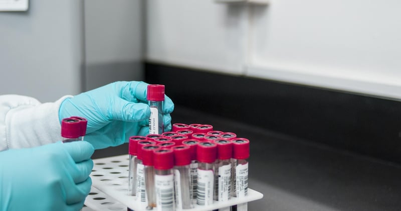 Metabolische Azidose erkennen: Warnsignale und was dagegen hilft